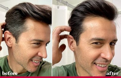 年紀輕輕就長白頭發？從沐浴用品到生活方式的全方位應對指南