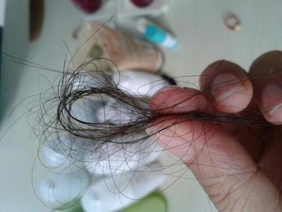 梳洗之擾，發絲何故漸疏？——探析洗浴用品與女性脫發加劇的關聯